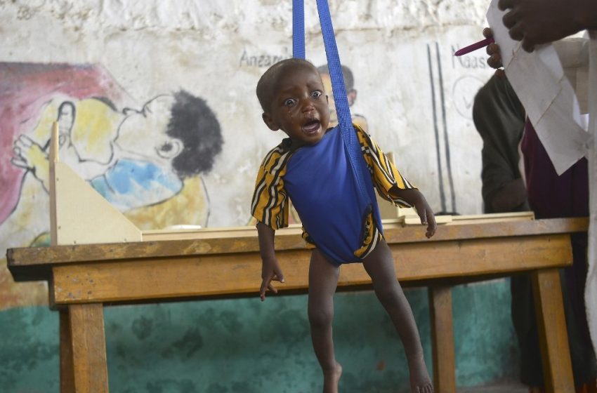 La famine est elle plus meurtrière que le Covid-19 ?