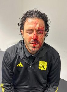 Enquêtes ouvertes après l’annulation du match OL-OM