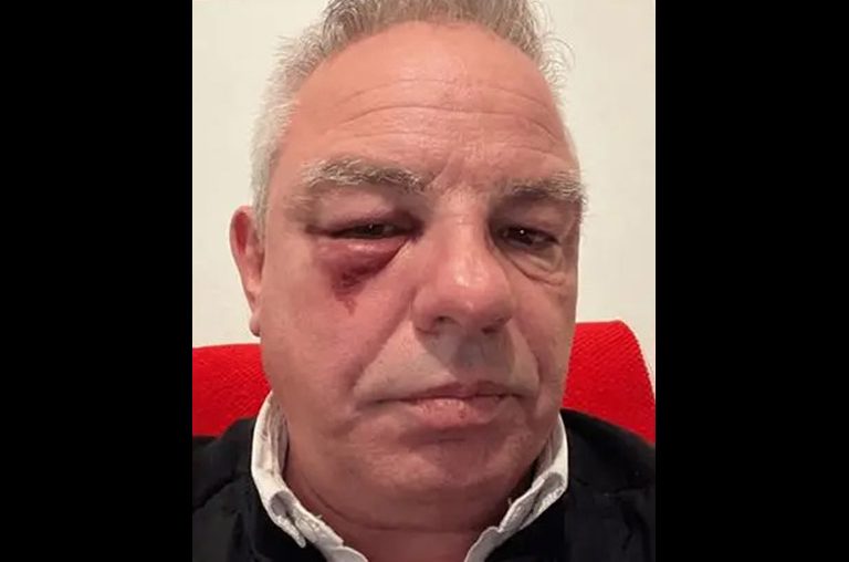  Un maire et sa famille agressés après des propos racistes envers sa nièce métisse