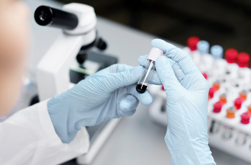 Maroc. Reprogrammation de cellules sanguines en cellules souches pluripotentes induites