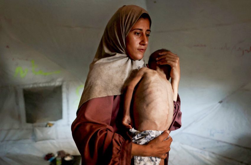 Une mère palestinienne porte son fils de 18 mois présentant des signes de malnutrition dans un camp de réfugiés à Gaza.